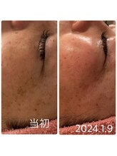 シャインクラフト/