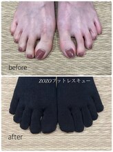 ゾゾ イリプレッセブル(ZOZO irreplaceable)/５本指ソックス