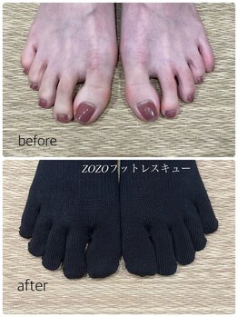 ゾゾ イリプレッセブル(ZOZO irreplaceable)/5本指ソックス