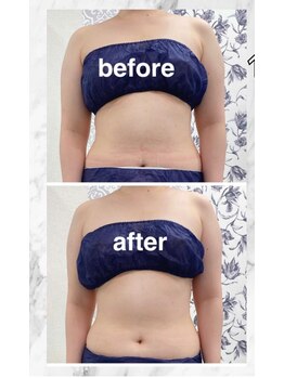 ハロ 南青山(HALO)/お腹ボディスタンプ☆10PUSH