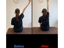 リ エスペランサ(Re.Esperanza)/整体/東十条駅/赤羽駅/鍼灸/腰痛