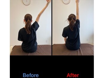 リ エスペランサ(Re.Esperanza)/整体/東十条駅/赤羽駅/鍼灸/腰痛