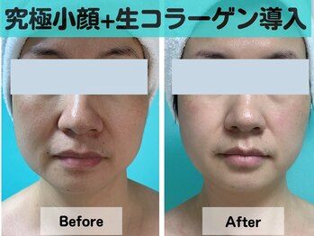 ナナ 銀座(Nana)/秋に一番おすすめフェイシャル