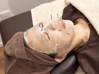 御徒町よつば整骨院/幹細胞美容鍼