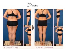 ビノス(Binosu)の雰囲気（【エンダモロジー痩身】背中やお尻、お腹などの脂肪にアプローチ）