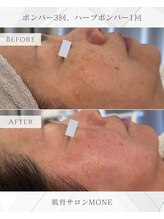 モネ オキナワ(MONE okinawa.)/うなはだけつ