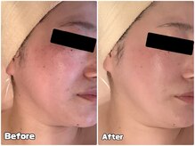 アイビジン 四日市店(I BiJiN)の雰囲気（深部加温リガメントフェイシャル☆肌質改善/小顔/たるみ/シミ）