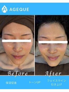 アジーク 町田店(AGEQUE)/肌診断機で今の肌を知ろう
