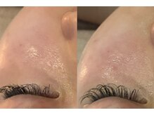 アロマビューティーサロン ジェイハウス(J)/太もも