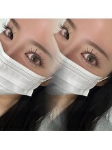 アイミー(Aimy)/シングルフラット140本