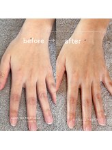 ゼロハチイチ(081)/Hand Spa Treatment