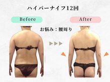 美容整体 ウェリナ 蟹江院/小顔矯正/骨盤矯正/痩身整体