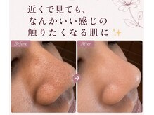 マグノリア(Magnolia)の雰囲気(【毛穴ケア】古い角質を除去し、超音波で保水、艶肌へ♪)