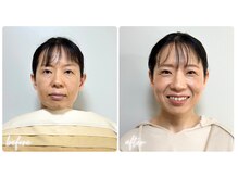 スタイルキューピット(style cupit)/メイクビフォアフター＊40代