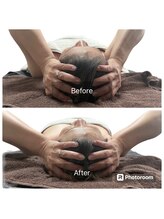 スカイ(sky)/頭蓋骨立体小顔矯正