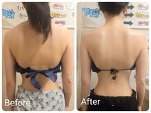 スマイルボディ つぼの森 加治木店(Smile body)/ブライダルエステ