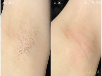 グレイス 久留米店(GRACE)/脇WAX