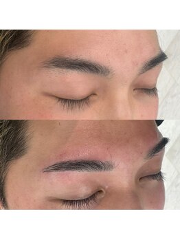 ビュー テンジン 天神 大名(VIEW TENJIN)/アイブロウ（眉毛）WAX脱毛