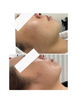 ルアナ(Luana)/今話題の！！！【レモンボトル】