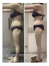 エステティック レイビス 川崎店(RAYVIS)/