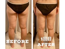 リサスミー(Lithas Me)/美尻もお任せ☆