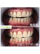 ルブラン 奈良店(Le Blanc)/お客様ご紹介キャンペーン