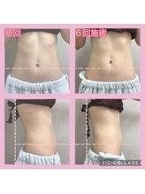 ラニ(LANI)/Before&After