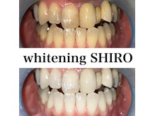 福岡ホワイトニングシロ 天神中洲店(福岡ホワイトニングSHIRO)の雰囲気（【圧倒的効果実感!!】ホワイトニング未経験の方も大歓迎です♪）