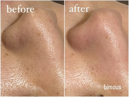 ビモアス(bimous)の写真