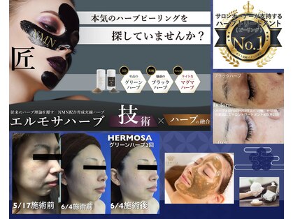 ベオ(Salon Beo)の写真