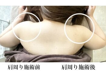 ミセル(MISEL2nd)/キープ力◎リピートNo.1最新痩身