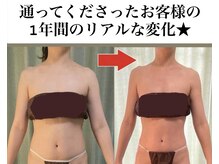 リラクゼーションサロン アイリス(IRIS)/痩身コース