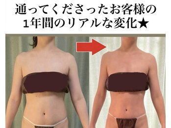 リラクゼーションサロン アイリス(IRIS)/痩身コース
