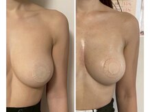 ルナグランデ(Luna grande.)の雰囲気（【脂肪そのものを増やすバストアップケア】当店No.1メニュー★★）