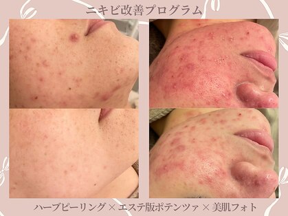 メゾンリュバン 梅田店(Maison Ruban)の写真