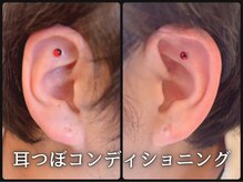 ルース(LUZ)/メンズ耳つぼコンディショニング