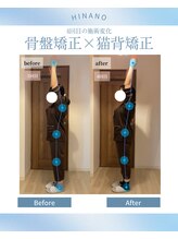 ヒナノ 矢場町店(HINANO)/骨盤矯正×猫背矯正