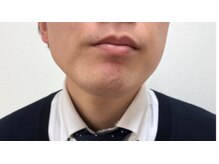 ビューティーボディ 名寄(The Beauty Body)/メンズヒゲ脱毛