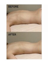 マルレ 三軒茶屋(MARLE)/筋肉、筋膜からアプローチ