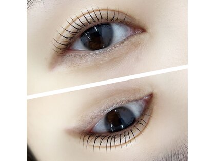 リングドット(LinG.)の写真