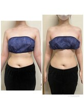 スマイルボディ つぼの森 加治木店(Smile body)/ブライダル