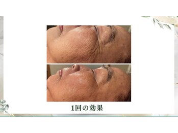 サロンドエクラ 南堀江(salon de eclat)/韓国最先端美容