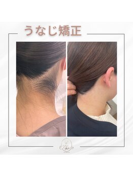 ミース 宮崎店/うなじ矯正でこんなに変わる!