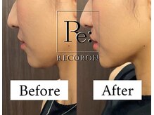 リコロン 銀座(Re:)