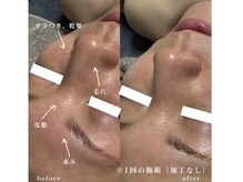 エルム 京都駅前店(elm)/＊プラズマニア＊