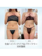 エスプレッソ(espresso,)/引き締まったウエストに★