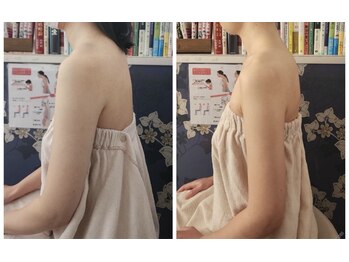 ミエリフル(Miel et Fleurs)/なで肩も1回でこちらの変化