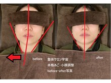 整体サロン宇宙/☆本格あご・小顔矯正☆