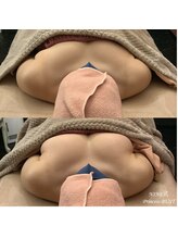 レーヴ(Reve)/バストアップ/バストケア/下垂