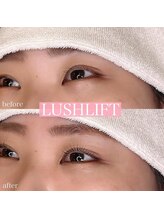 リンド エステ まつげ 京成大久保(Lind)/ラッシュリフト